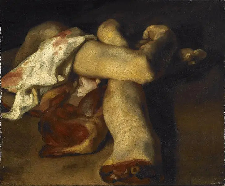 Anatomiset palat - Théodore Géricault